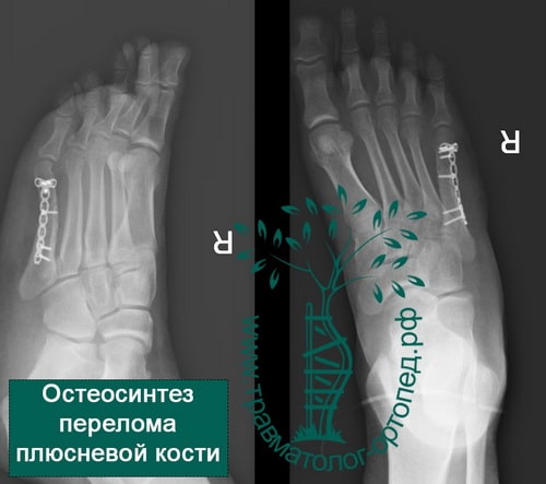 Магнитотерапия